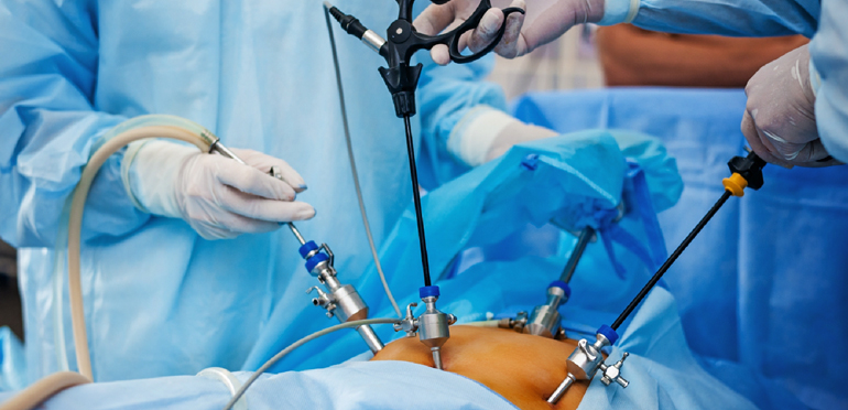 Laparoscopic Urological Procedures - Dr. Shyam Mohan